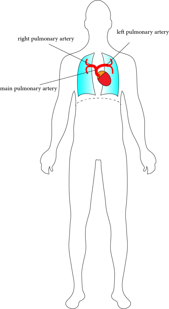 Sketch of the arteries in the pulmonary circulation in the human body