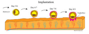 Diagram to show the implantation of a blastocyst in the uterine wall